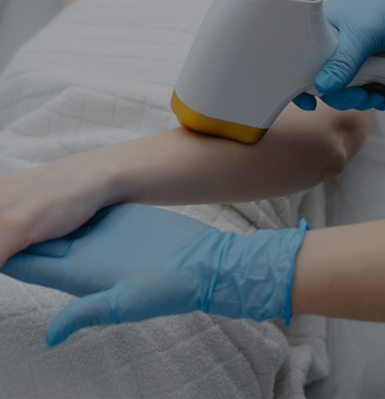 Laser Hair Removal